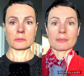 [Анна Ахметшина] Красота и омоложение (2019)_0.png